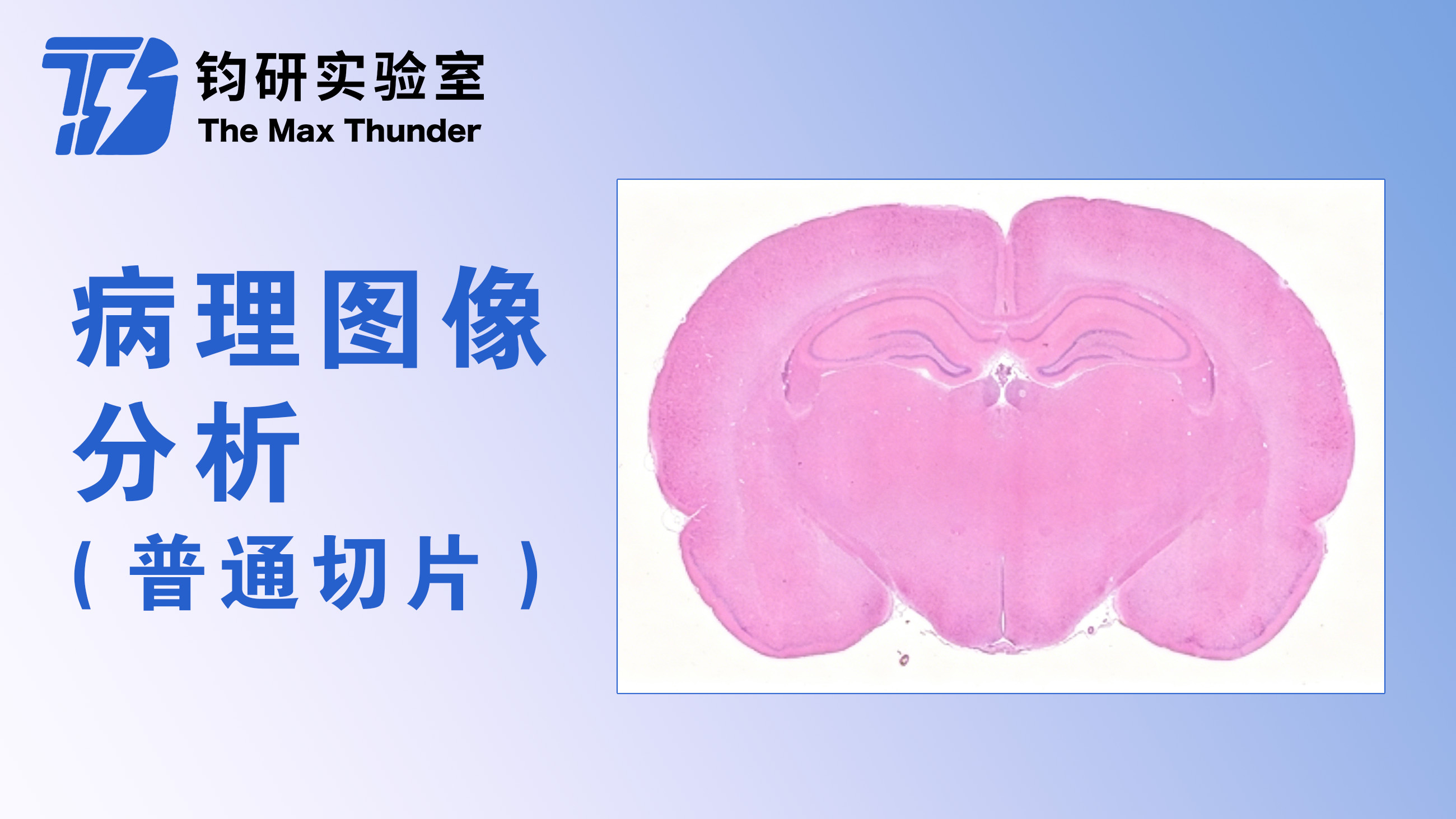 病理图像分析(普通切片)