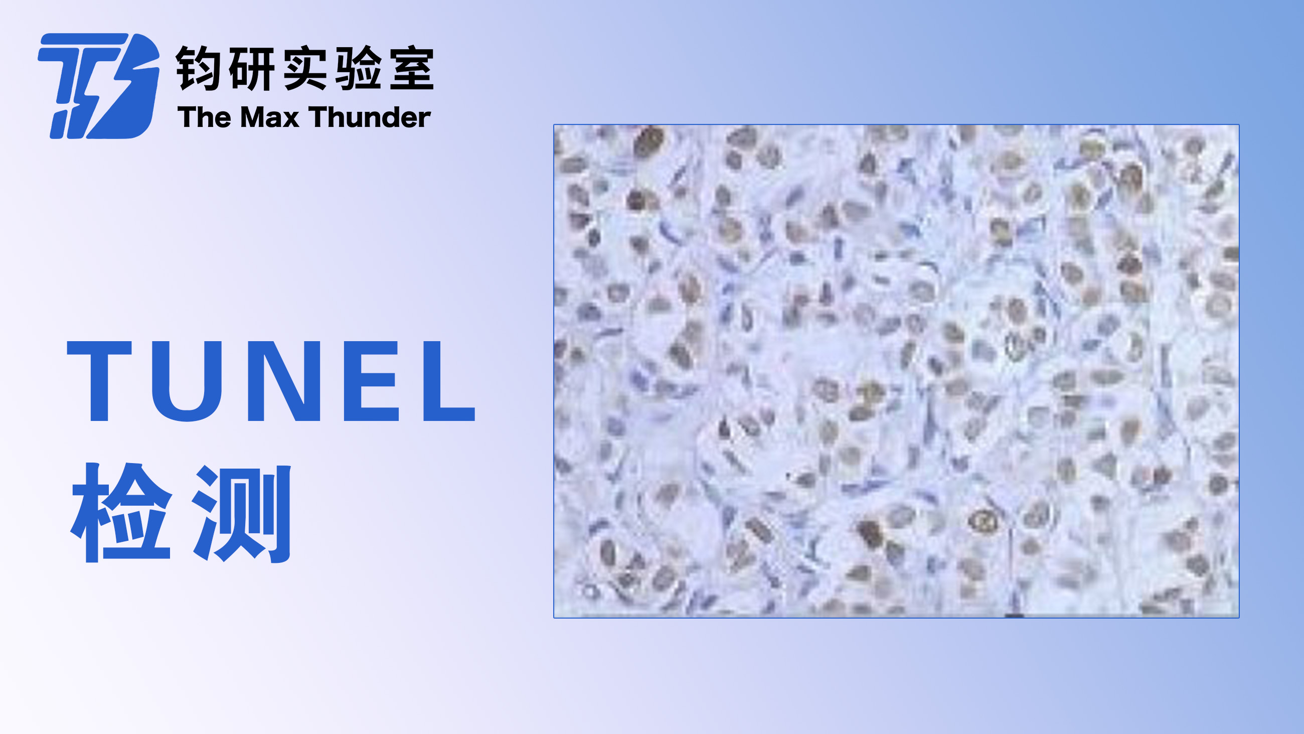 TUNEL检测