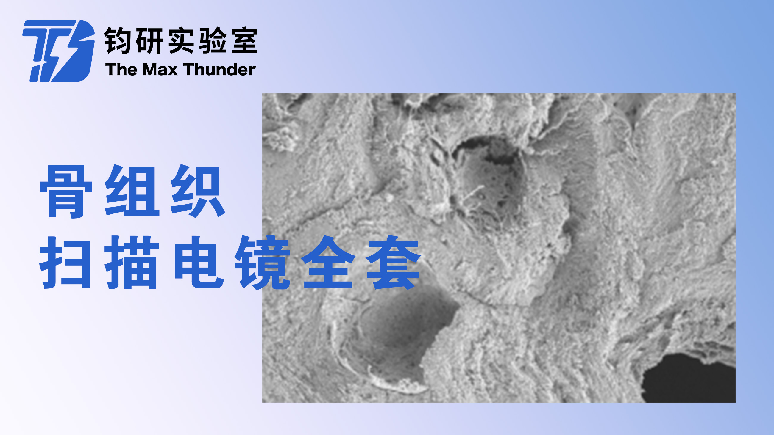 骨组织扫描电镜全套