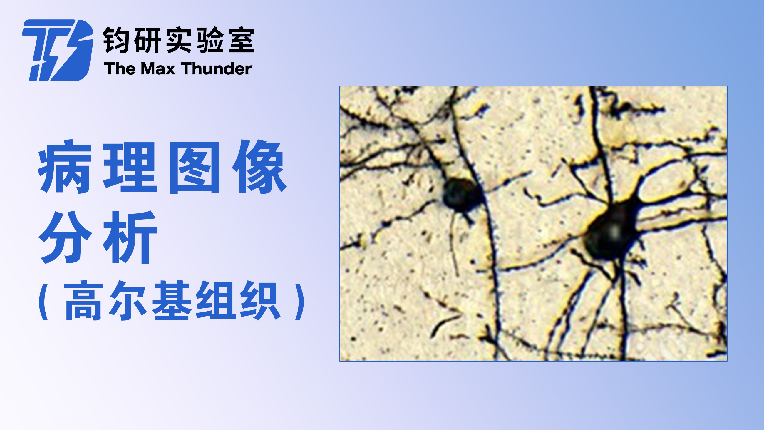 病理图像分析(高尔基组织)
