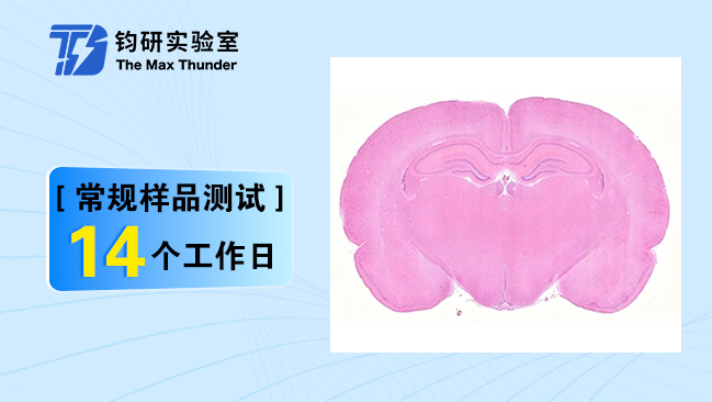 病理图像分析(普通切片)