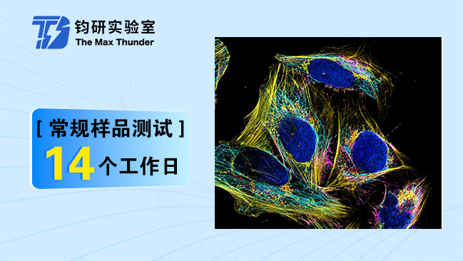 激光共聚焦超高分辨Lightning拍照