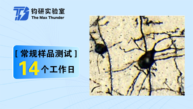 病理图像分析(高尔基组织)