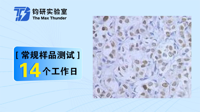 TUNEL检测